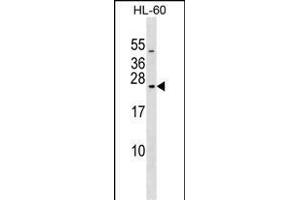 RAB20 Antibody (C-term) (ABIN1536837 and ABIN2849183) western blot analysis in HL-60 cell line lysates (35 μg/lane). (RAB20 anticorps  (C-Term))