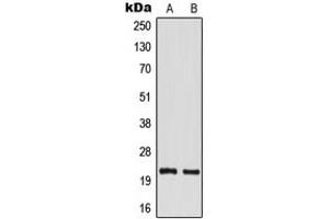 Western blot analysis of TM2D1 expression in MCF7 (A), mouse kidney (B) whole cell lysates. (TM2D1 anticorps  (Center))