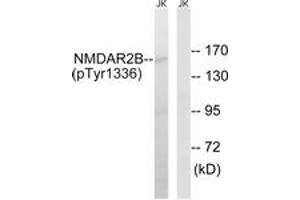 Western blot analysis of extracts from Jurkat cells treated with TNF 20ng/ml 30', using NMDAR2B (Phospho-Tyr1336) Antibody. (GRIN2B anticorps  (pTyr1336))