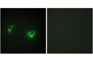 Immunofluorescence (IF) image for anti-Mitogen-Activated Protein Kinase Kinase Kinase Kinase 4 (MAP4K4) (AA 406-455) antibody (ABIN2889367) (MAP4K4 anticorps  (AA 406-455))
