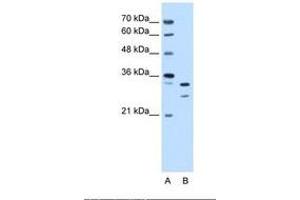 Image no. 2 for anti-Acidic (Leucine-Rich) Nuclear phosphoprotein 32 Family, Member E (ANP32E) (AA 151-200) antibody (ABIN6738242) (ANP32E anticorps  (AA 151-200))