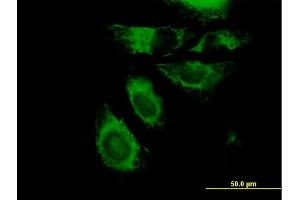 Immunofluorescence of purified MaxPab antibody to KRT7 on HeLa cell. (Cytokeratin 7 anticorps  (AA 1-469))