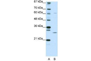 WB Suggested Anti-CRSP9  Antibody Titration: 0. (MED7 anticorps  (N-Term))