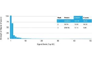 Analysis of Protein Array containing more than 19,000 full-length human proteins using MAGEA4 Mouse Monoclonal Antibody (CPTC-MAGEA4-1).