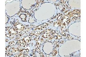 IHC analysis of TTLL12 using anti-TTLL12 antibody (ABIN7602497). (TTLL12 anticorps  (AA 8-634))