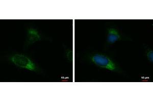 ICC/IF Image UGCGL2 antibody [N3C2], Internal detects UGCGL2 protein at endoplasmic reticulum by immunofluorescent analysis. (UGCGL2 anticorps)
