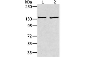 Gel: 6 % SDS-PAGE, Lysate: 40 μg, Lane 1-2: A431 and 293T cell, Primary antibody: ABIN7189660(ADAMTS2 Antibody) at dilution 1/200 dilution, Secondary antibody: Goat anti rabbit IgG at 1/8000 dilution, Exposure time: 1 minute