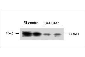 Western blot analysis of extracts from 293T cells that were transfected with si-control or transfected si-PCIA1, using rabbit polyclonal PCIA1 Antibody (Center) (ABIN658015 and ABIN2846953).