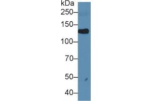 Western blot analysis of Rat Serum, using Rat LIFR Antibody (1 µg/ml) and HRP-conjugated Goat Anti-Rabbit antibody ( (LIFR anticorps  (AA 382-486))