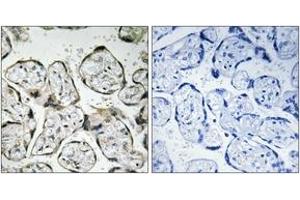 Immunohistochemistry analysis of paraffin-embedded human placenta tissue, using MT-ND1 Antibody.