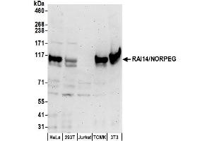 anti-Retinoic Acid Induced 14 (RAI14) (AA 1-50) antibody