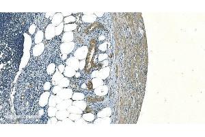 IHC analysis of H Cadherin/CDH13 using anti-H Cadherin/CDH13 antibody (ABIN7600095).