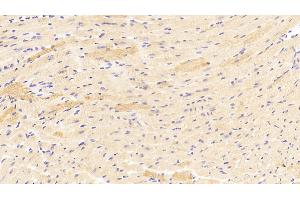 Detection of ROR1 in Mouse Heart Tissue using Polyclonal Antibody to Receptor Tyrosine Kinase Like Orphan Receptor 1 (ROR1) (ROR1 anticorps  (AA 470-707))