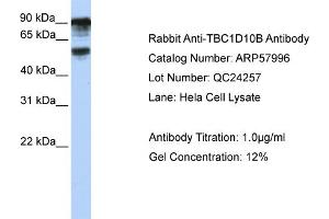 WB Suggested Anti-TBC1D10B  Antibody Titration: 0. (TBC1D10B anticorps  (C-Term))