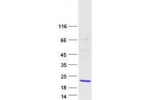 Validation with Western Blot