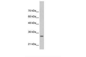 Image no. 2 for anti-Transcription Factor MafB (MAFB) (AA 41-90) antibody (ABIN6736309) (MAFB anticorps  (AA 41-90))