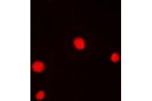 Immunofluorescent analysis of GABPB1 staining in Hela cells.