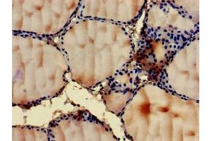 Immunohistochemistry of paraffin-embedded human thyroid tissue using ABIN7144546 at dilution of 1:100