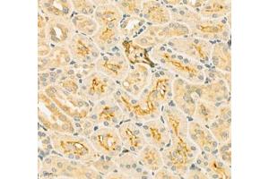Immunohistochemistry of paraffin embedded rat kidney using SLC6A19 (ABIN7075682) at dilution of 1:900 (400x lens) (SLC6A19 anticorps)