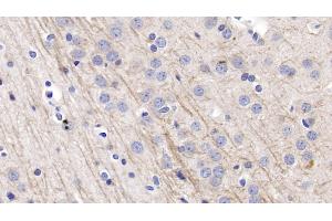 Detection of NRG1 in Rat Cerebrum Tissue using Polyclonal Antibody to Neuregulin 1 (NRG1)