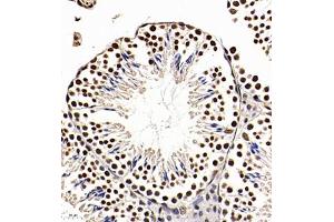 Immunohistochemistry of paraffin embedded mouse testis using Api5 (ABIN7073094) at dilution of 1:350 (400x lens) (Apoptosis Inhibitor 5 anticorps)