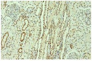 Image no. 3 for anti-Heterogeneous Nuclear Ribonucleoprotein L (HNRNPL) antibody (ABIN108560) (HNRNPL anticorps)
