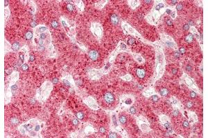 Rabbit Anti-CRIP1 antibody  Formalin Fixed Paraffin Embedded Tissue: Human Liver Primary antibody Concentration: 1:100 Secondary Antibody: Donkey anti-Rabbit-Cy3 Secondary Antibody Concentration: 1:200 Magnification: 20x Exposure Time: 0.