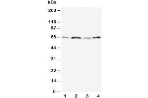 Western blot testing of OPN antibody and Lane 1:  MM231;  2: HeLa;  3: Jurkat;  4: COLO320 cell lysate. (Osteopontin anticorps  (N-Term))