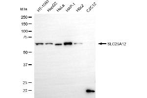 Western blotting analysis using SLC25A12 antibody (ABIN7800391).