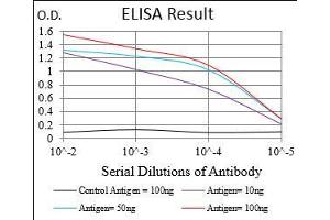 Black line: Control Antigen (100 ng), Purple line: Antigen(10 ng), Blue line: Antigen (50 ng), Red line: Antigen (100 ng), (DAPK3 anticorps  (AA 28-161))