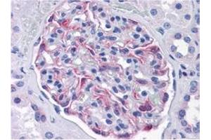 Immunohistochemistry (IHC) image for anti-Solute Carrier Family 44, Member 2 (SLC44A2) (AA 123-231) antibody (ABIN614725)