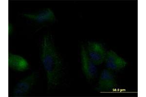 Immunofluorescence of monoclonal antibody to KRT20 on U-2 OS cell. (KRT20 anticorps  (AA 1-424))