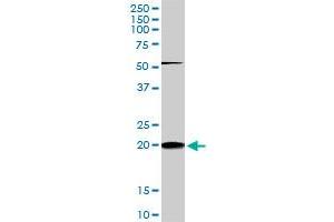 RHOC monoclonal antibody (M01), clone 2E12.