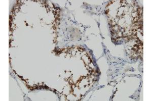 Immunoperoxidase of monoclonal antibody to POMZP3 on formalin-fixed paraffin-embedded human testis. (POMZP3 anticorps  (AA 64-116))