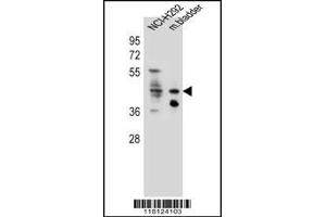Western blot analysis in NCI-H292 cell line and mouse bladder tissue lysates (35ug/lane). (Goldenhar Syndrome anticorps  (C-Term))