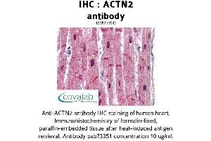 Image no. 1 for anti-Actinin, alpha 2 (ACTN2) (AA 215-500) antibody (ABIN1731491)