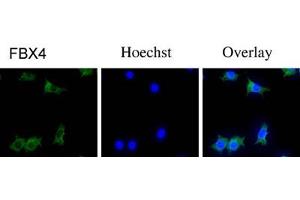 Immunofluorescence staining of NIH/3T3 cells with FBX4 polyclonal antibody  . (FBXO4 anticorps  (N-Term))