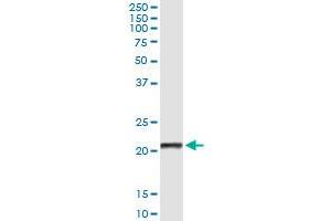 Immunoprecipitation of CLEC1B transfected lysate using anti-CLEC1B monoclonal antibody and Protein A Magnetic Bead , and immunoblotted with CLEC1B MaxPab rabbit polyclonal antibody.