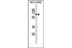 Western blot analysis of KBTBD10 Antibody (C-term) in NCI-H292 cell line lysates (35ug/lane).