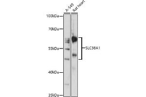 Western blot analysis of extracts of various cell lines, using SLC38 antibody (ABIN7270455) at 1:1000 dilution.