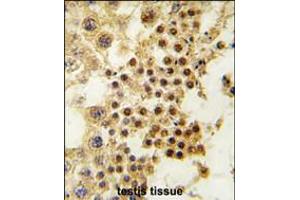 Formalin-fixed and paraffin-embedded human testis tissue reacted with GDF3 antibody , which was peroxidase-conjugated to the secondary antibody, followed by DAB staining.