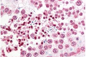 Anti-INADL antibody IHC staining of human testis. (PATJ anticorps  (AA 2-14))