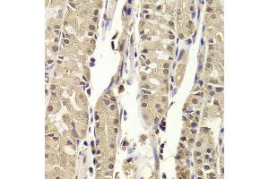 Immunohistochemistry of paraffin-embedded Human gastric using BLZF1 antibody at dilution of 1:100 (x400 lens). (BLZF1 anticorps)