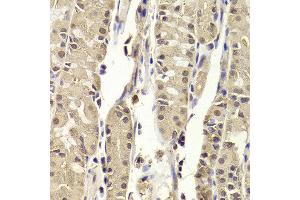 Immunohistochemistry of paraffin-embedded Human gastric using BLZF1 antibody at dilution of 1:100 (x400 lens).