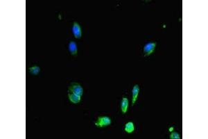 Immunofluorescent analysis of Hela cells using ABIN7150287 at dilution of 1:100 and Alexa Fluor 488-congugated AffiniPure Goat Anti-Rabbit IgG(H+L) (RAD51 anticorps  (AA 1-228))