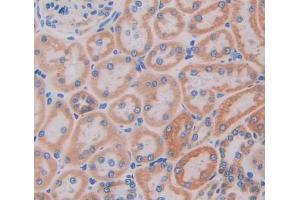 Used in DAB staining on fromalin fixed paraffin- embedded kidney tissue