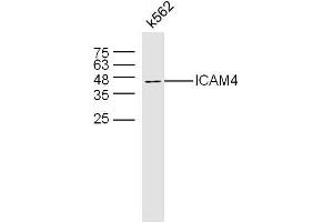 K562 lysates probed with ICAM4 Polyclonal Antibody, Uconjugated  at 1:300 overnight at 4°C followed by a conjugated secondary antibody at 1:10000 for 60 minutes at 37°C. (ICAM4 anticorps  (AA 85-180))