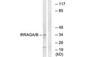 Western blot analysis of extracts from HepG2 cells, using RRAGA/B Antibody.