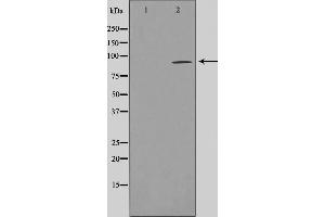 Western blot analysis on LOVO cell lysate using AKAP2 Antibody,The lane on the left is treated with the antigen-specific peptide. (AKAP2 anticorps  (N-Term))
