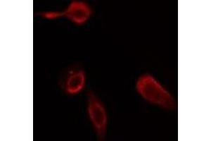 ABIN6275785 staining Hela cells by IF/ICC.
